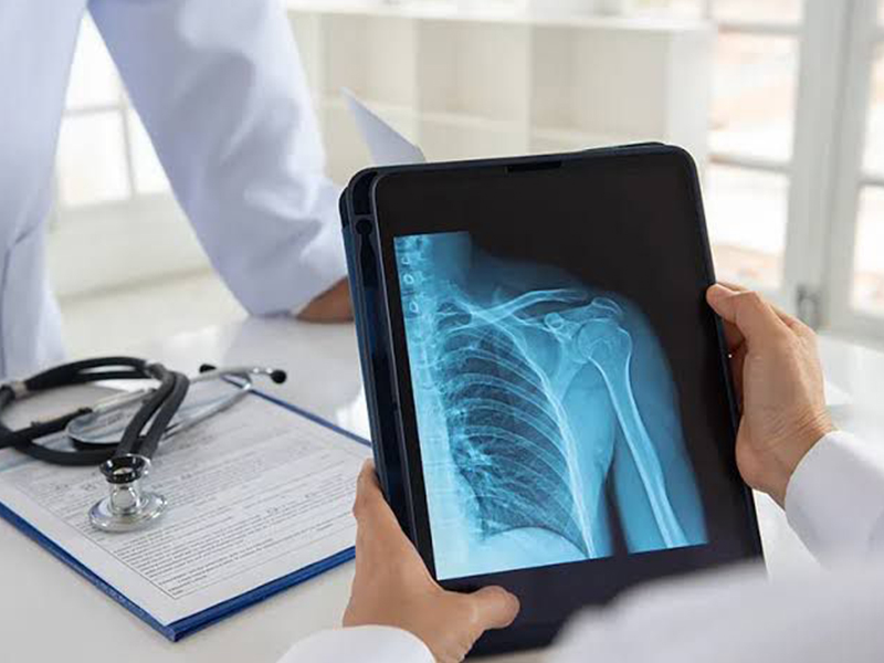 X-Ray Department