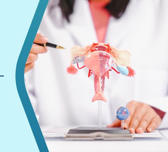 PCOS Management