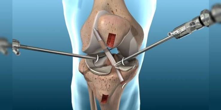 Orthopedic